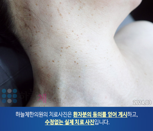피부질환