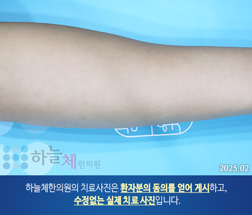 피부질환